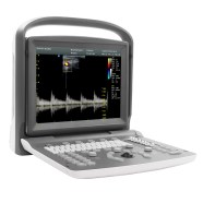 Ultrasonido Chison Eco2